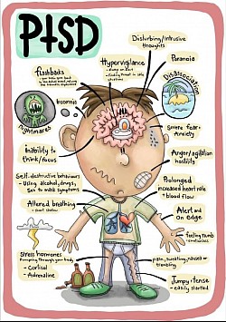 Ptsd